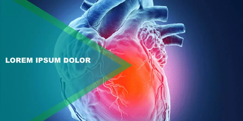 Hjerteanfald Google Slides skabelon for download