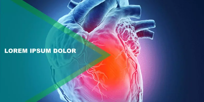 attacco di cuore modello di Presentazioni Google da scaricare