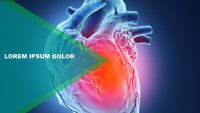 Hjerteanfald Google Slides skabelon for download