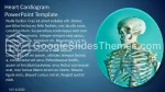 Kardiologia Kardiogram Serca Gmotyw Google Prezentacje Slide 03