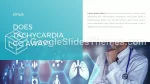 Kardiologi Sinus Google Presentationer-Tema Slide 15